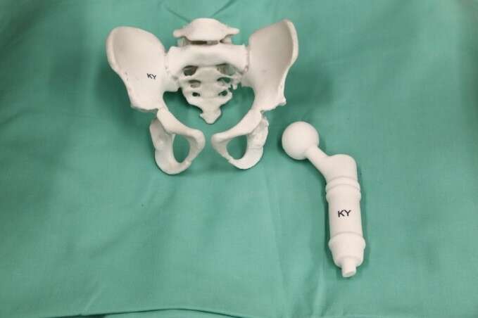 3D printed pelvic model